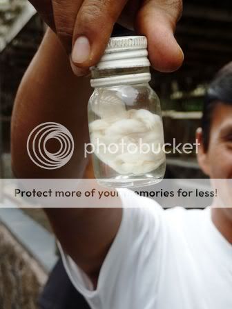 3+Month+Old+Fetus http://www.shutterstock.com/pic-7079308/stock-photo-ultrasound-image ...